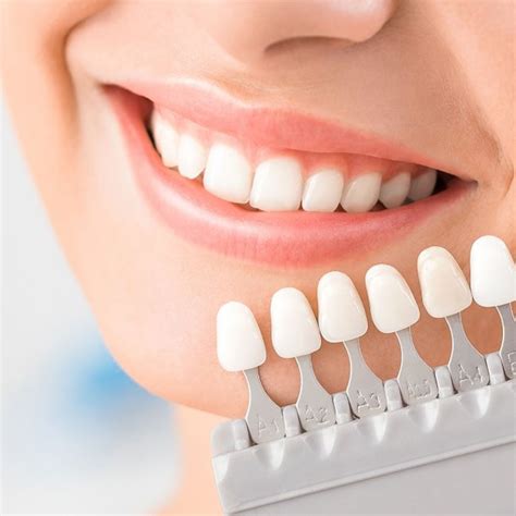 Complete Guide For Getting Veneers In Turkey : u/astadent.